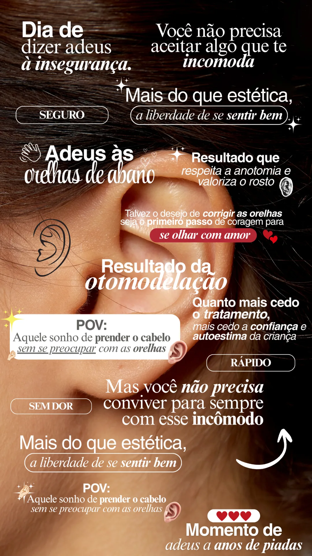 Exemplos de figurinhas StoryHOF para Otomodelação